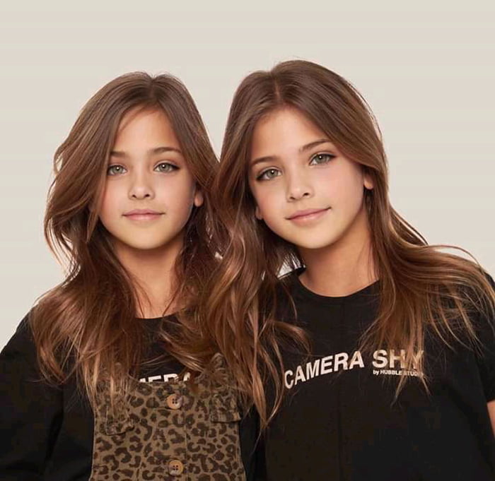 Remember The World’s Most Beautiful Twins? Here’s What They Look Like Today