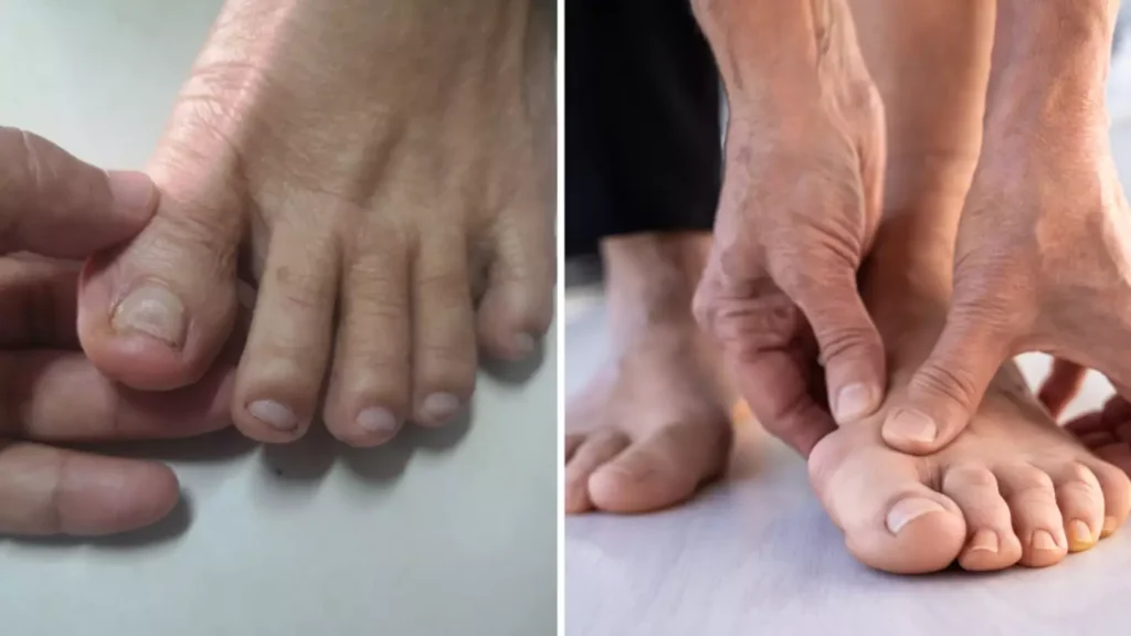 Pharmacist reveals two warning signs of silent killer that you might spot in your feet